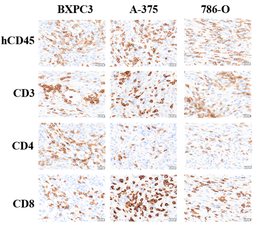 Significant human immune cell infiltration in the humanized immune system of xenografted tumors.